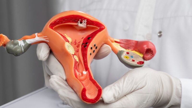 Março Lilás: diagnóstico precoce do câncer de colo do útero e avanços da cirurgia robótica