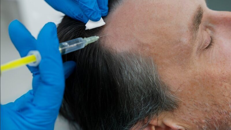 Cuidado capilar masculino ganha espaço nos consultórios dermatológicos