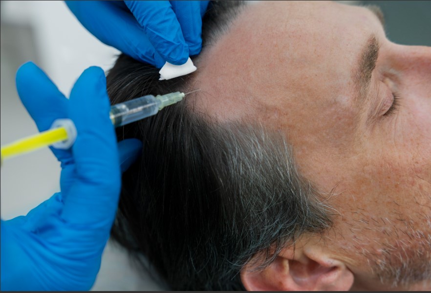 Cuidado capilar masculino ganha espaço nos consultórios dermatológicos
